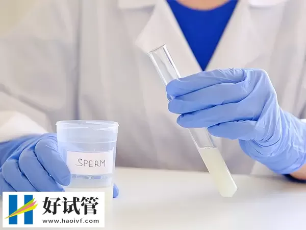 试管婴儿取精前男方需要做哪些检查(图1) 试管婴儿取精前男方需要做哪些检查(图1)