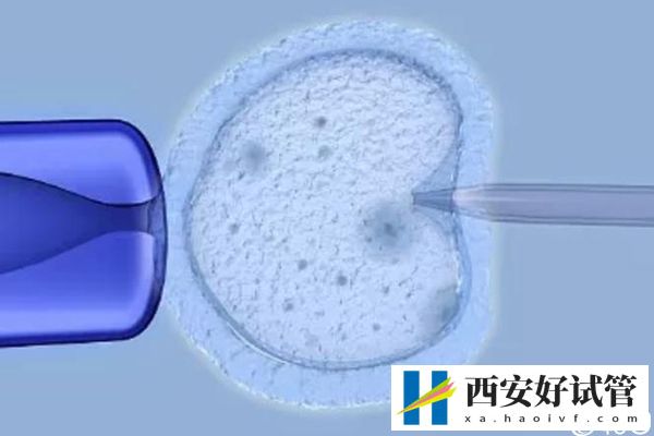 西安一代试管大概多少钱答案在这,附top10机构排名(图2) 西安一代试管大概多少钱答案在这,附top10机构排名(图2)