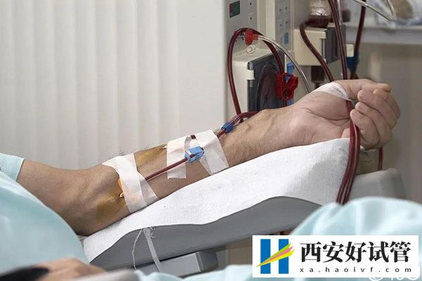 男性透析有生育能力也别乱做试管婴儿,请了解下成功率再说(图2) 男性透析有生育能力也别乱做试管婴儿,请了解下成功率再说(图2)