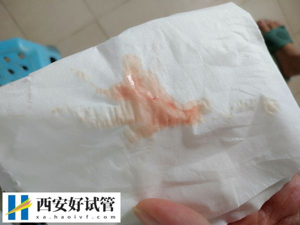 降调针冷藏了拿出来什么时候可以打(图2) 降调针冷藏了拿出来什么时候可以打(图2)