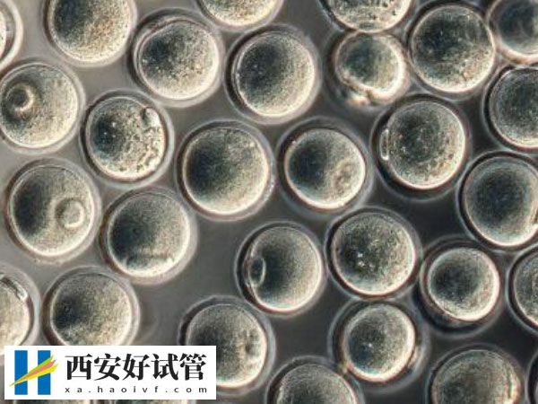 短方案促排卵为什么不需要吃药(图2) 短方案促排卵为什么不需要吃药(图2)