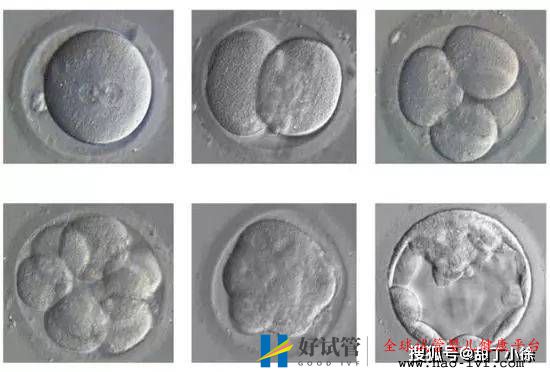 试管婴儿移植后多久算成功(图1) 试管婴儿移植后多久算成功(图1)