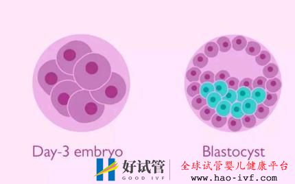 试管婴儿胚胎医生为什么建议养囊,而不是冷冻?(图1) 试管婴儿胚胎医生为什么建议养囊,而不是冷冻?(图1)